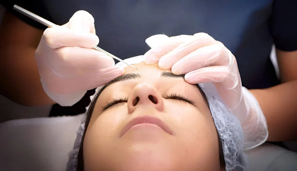 Eyebrow Transplantation Cost In India